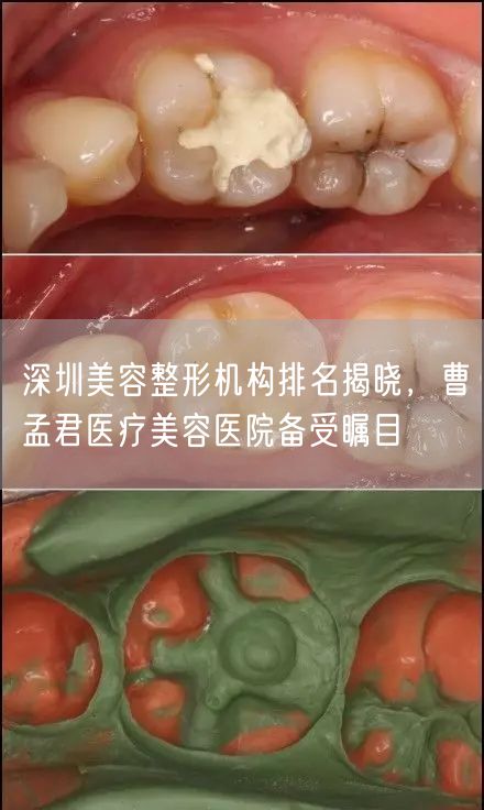 深圳美容整形机构排名揭晓，曹孟君医疗美容医院备受瞩目