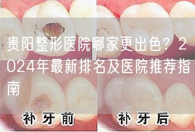 贵阳整形医院哪家更出色？2024年最新排名及医院推荐指南