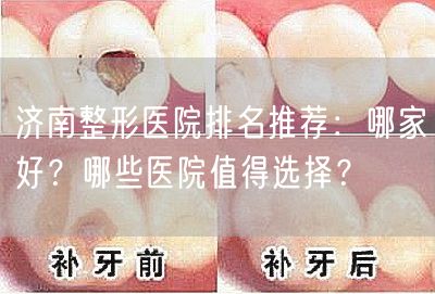 济南整形医院排名推荐：哪家好？哪些医院值得选择？