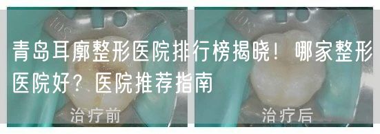 青岛耳廓整形医院排行榜揭晓！哪家整形医院好？医院推荐指南