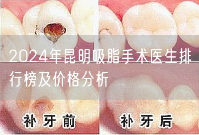 2024年昆明吸脂手术医生排行榜及价格分析