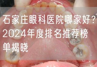 石家庄眼科医院哪家好？2024年度排名推荐榜单揭晓