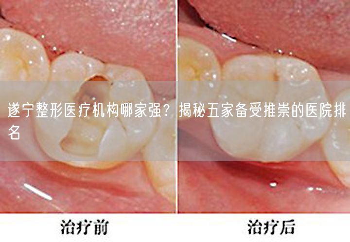 遂宁整形医疗机构哪家强？揭秘五家备受推崇的医院排名
