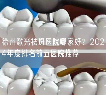 徐州激光祛斑医院哪家好？2024年度排名前五医院推荐