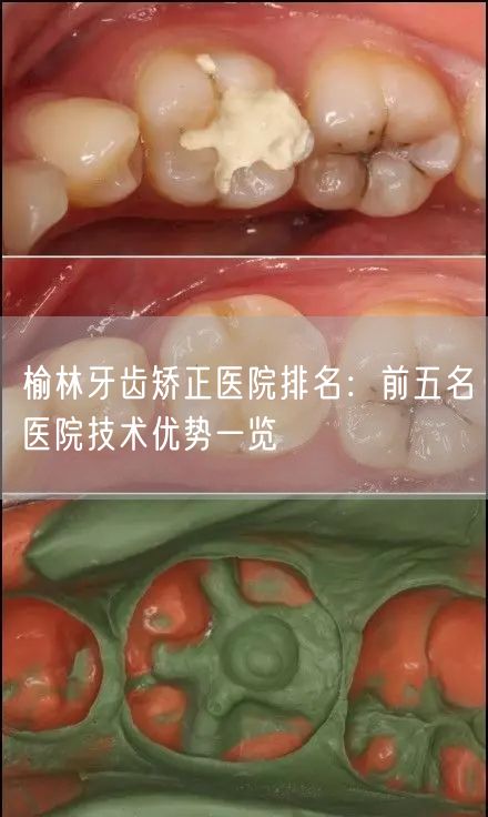 榆林牙齿矫正医院排名：前五名医院技术优势一览