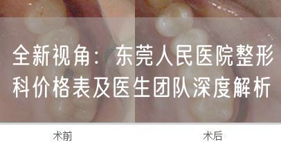 全新视角：东莞人民医院整形科价格表及医生团队深度解析