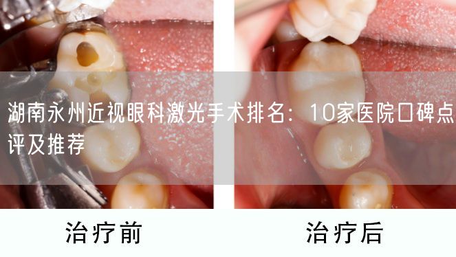 湖南永州近视眼科激光手术排名：10家医院口碑点评及推荐