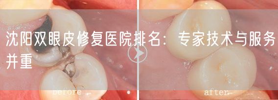 沈阳双眼皮修复医院排名：专家技术与服务并重