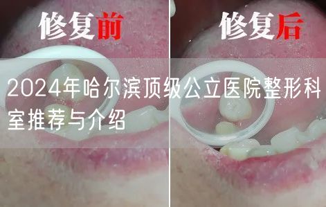 2024年哈尔滨顶级公立医院整形科室推荐与介绍