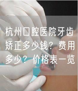 杭州口腔医院牙齿矫正多少钱？费用多少？价格表一览