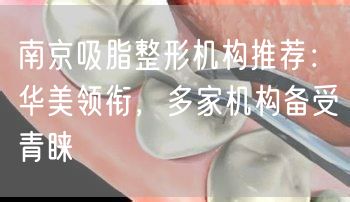 南京吸脂整形机构推荐：华美领衔，多家机构备受青睐