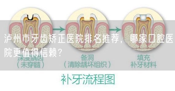 泸州市牙齿矫正医院排名推荐，哪家口腔医院更值得信赖？