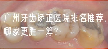 广州牙齿矫正医院排名推荐，哪家更胜一筹？