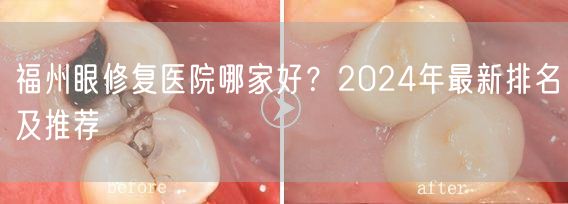 福州眼修复医院哪家好？2024年最新排名及推荐