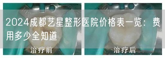 2024成都艺星整形医院价格表一览：费用多少全知道