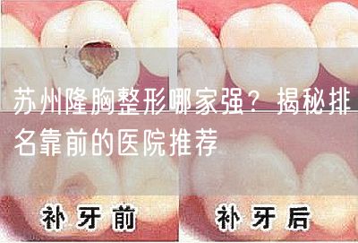 苏州隆胸整形哪家强？揭秘排名靠前的医院推荐