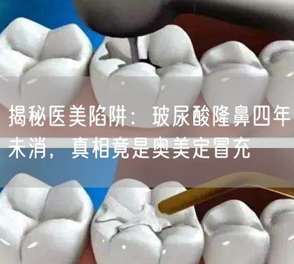 揭秘医美陷阱：玻尿酸隆鼻四年未消，真相竟是奥美定冒充