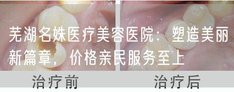 芜湖名姝医疗美容医院：塑造美丽新篇章，价格亲民服务至上