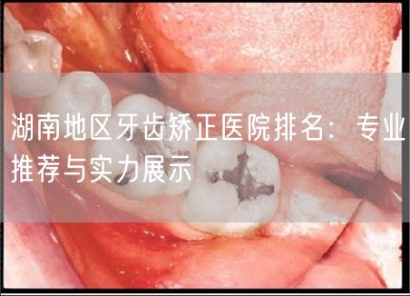 湖南地区牙齿矫正医院排名：专业推荐与实力展示