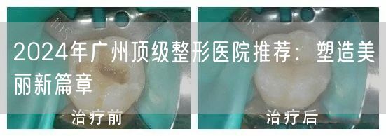 2024年广州顶级整形医院推荐：塑造美丽新篇章