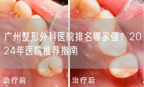 广州整形外科医院排名哪家强？2024年医院推荐指南