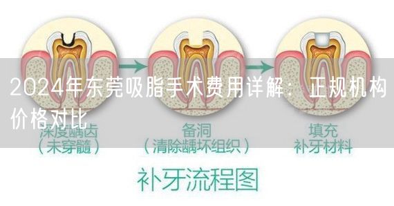 2024年东莞吸脂手术费用详解：正规机构价格对比