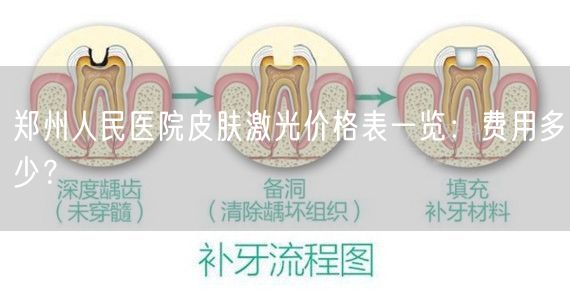 郑州人民医院皮肤激光价格表一览：费用多少？