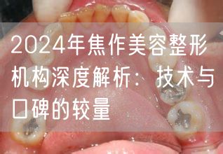2024年焦作美容整形机构深度解析：技术与口碑的较量