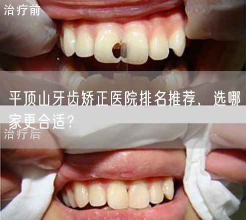 平顶山牙齿矫正医院排名推荐，选哪家更合适？