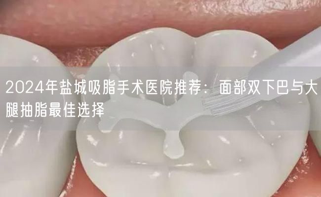 2024年盐城吸脂手术医院推荐：面部双下巴与大腿抽脂最佳选择