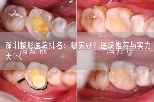 深圳整形医院排名：哪家好？医院推荐与实力大PK