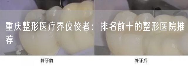 重庆整形医疗界佼佼者：排名前十的整形医院推荐