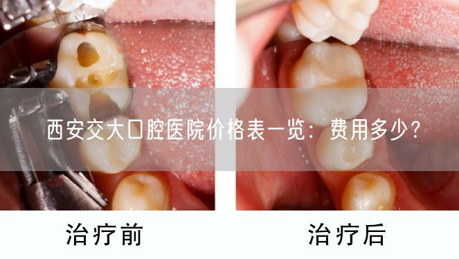 西安交大口腔医院价格表一览：费用多少？