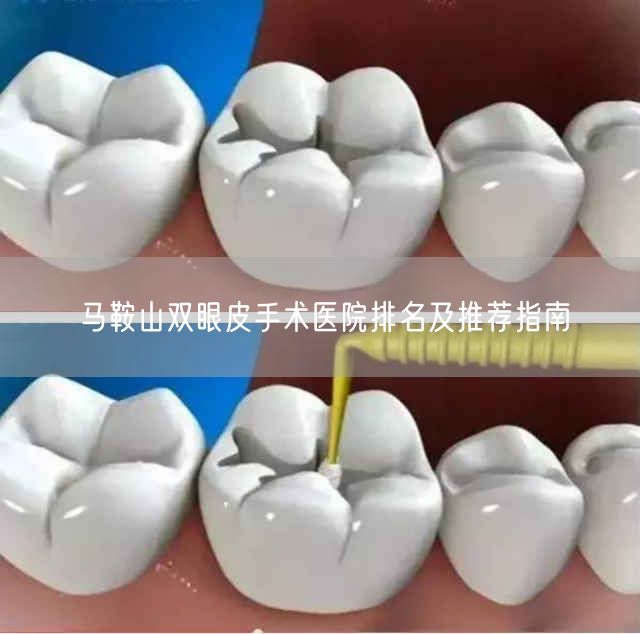 马鞍山双眼皮手术医院排名及推荐指南