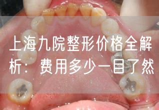 上海九院整形价格全解析：费用多少一目了然