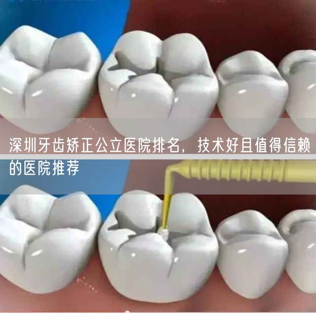 深圳牙齿矫正公立医院排名，技术好且值得信赖的医院推荐