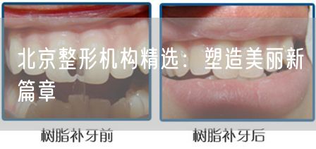 北京整形机构精选：塑造美丽新篇章