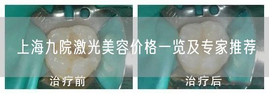 上海九院激光美容价格一览及专家推荐