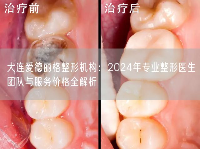 大连爱德丽格整形机构：2024年专业整形医生团队与服务价格全解析