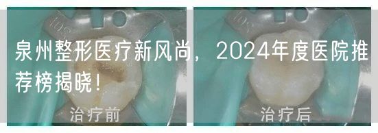 泉州整形医疗新风尚，2024年度医院推荐榜揭晓！