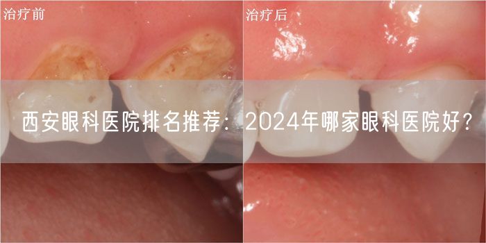 西安眼科医院排名推荐：2024年哪家眼科医院好？