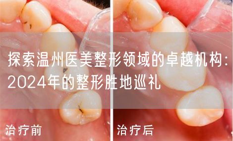 探索温州医美整形领域的卓越机构：2024年的整形胜地巡礼
