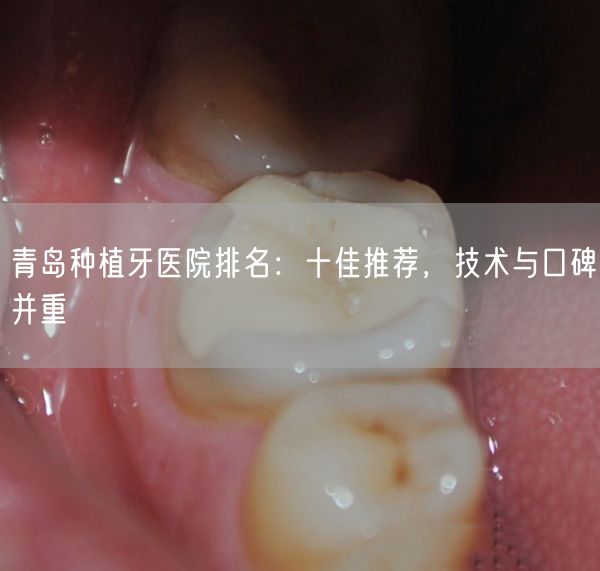 青岛种植牙医院排名：十佳推荐，技术与口碑并重