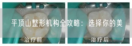平顶山整形机构全攻略：选择你的美