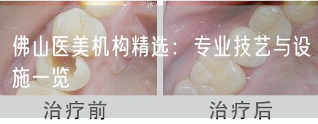 佛山医美机构精选：专业技艺与设施一览