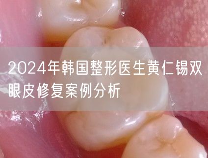 2024年韩国整形医生黄仁锡双眼皮修复案例分析
