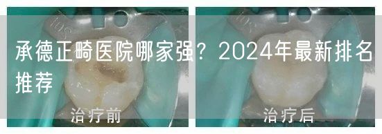 承德正畸医院哪家强？2024年最新排名推荐