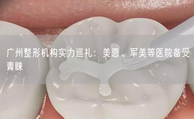 广州整形机构实力巡礼：美恩、军美等医院备受青睐