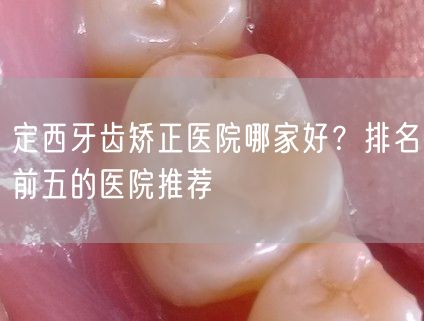 定西牙齿矫正医院哪家好？排名前五的医院推荐
