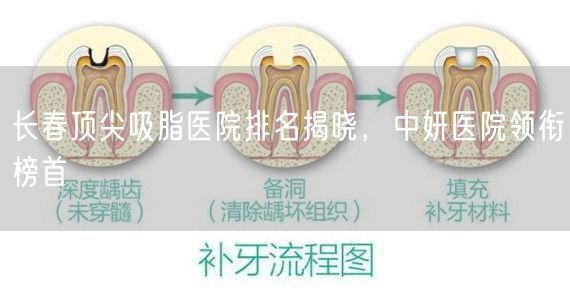 长春顶尖吸脂医院排名揭晓，中妍医院领衔榜首